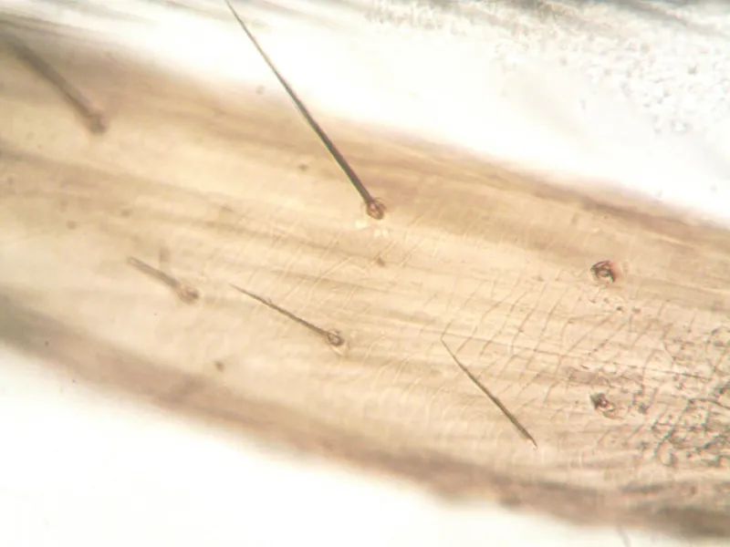 Scientists Finally Figured Out Why Stress Actually Does Turn Hair Gray — And It's Not What You Think